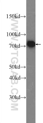 Moesin Antibody in Western Blot (WB)