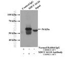 SDCCAG10 Antibody in Immunoprecipitation (IP)