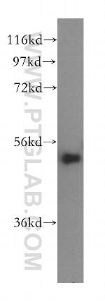 SDCCAG10 Antibody in Western Blot (WB)