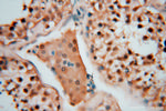 ARH3 Antibody in Immunohistochemistry (Paraffin) (IHC (P))