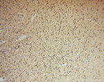 ARH3 Antibody in Immunohistochemistry (Paraffin) (IHC (P))