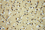 ARH3 Antibody in Immunohistochemistry (Paraffin) (IHC (P))