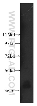 ARH3 Antibody in Western Blot (WB)