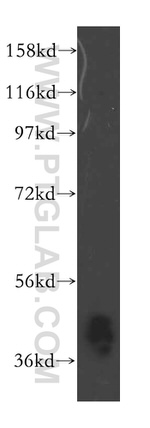 ARH3 Antibody in Western Blot (WB)