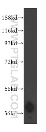 ARH3 Antibody in Western Blot (WB)