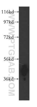 ARH3 Antibody in Western Blot (WB)