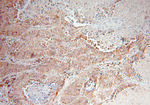 DUSP22 Antibody in Immunohistochemistry (Paraffin) (IHC (P))