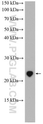 DUSP22 Antibody in Western Blot (WB)