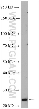 DUSP22 Antibody in Western Blot (WB)