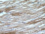 Desmin Antibody in Immunohistochemistry (Paraffin) (IHC (P))