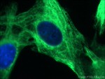 Desmin Antibody in Immunocytochemistry (ICC/IF)