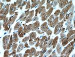 Desmin Antibody in Immunohistochemistry (Paraffin) (IHC (P))