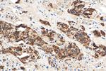 Prolactin Antibody in Immunohistochemistry (Paraffin) (IHC (P))