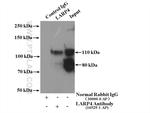 LARP4 Antibody in Immunoprecipitation (IP)