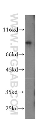 LARP4 Antibody in Western Blot (WB)