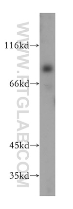 PALMD Antibody in Western Blot (WB)