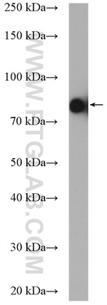 PALMD Antibody in Western Blot (WB)