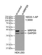 MRPS9 Antibody in Western Blot (WB)