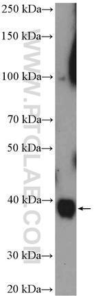 MRPS9 Antibody in Western Blot (WB)