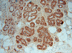 CTHRC1 Antibody in Immunohistochemistry (Paraffin) (IHC (P))