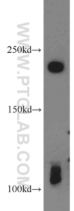 AXIN1 Antibody in Western Blot (WB)