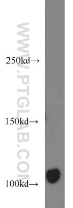 AXIN1 Antibody in Western Blot (WB)