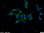 Napsin A Antibody in Immunocytochemistry (ICC/IF)