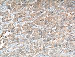 Napsin A Antibody in Immunohistochemistry (Paraffin) (IHC (P))