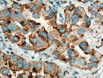 Napsin A Antibody in Immunohistochemistry (Paraffin) (IHC (P))