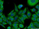 Cytokeratin 4 Antibody in Immunocytochemistry (ICC/IF)