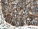 Cytokeratin 4 Antibody in Immunohistochemistry (Paraffin) (IHC (P))