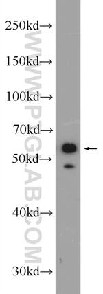 Cytokeratin 4 Antibody in Western Blot (WB)