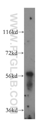 Cytokeratin 4 Antibody in Western Blot (WB)