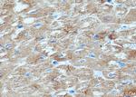 AGL Antibody in Immunohistochemistry (Paraffin) (IHC (P))