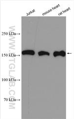 AGL Antibody in Western Blot (WB)