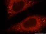 Pyruvate Carboxylase Antibody in Immunocytochemistry (ICC/IF)