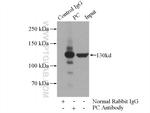 Pyruvate Carboxylase Antibody in Immunoprecipitation (IP)