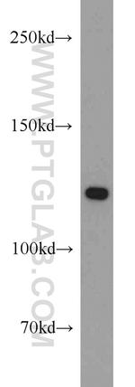 Pyruvate Carboxylase Antibody in Western Blot (WB)