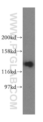 Pyruvate Carboxylase Antibody in Western Blot (WB)