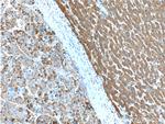 ACSM5 Antibody in Immunohistochemistry (Paraffin) (IHC (P))