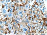 ACSM5 Antibody in Immunohistochemistry (Paraffin) (IHC (P))