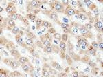 ACSM5 Antibody in Immunohistochemistry (Paraffin) (IHC (P))