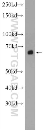 ACSM5 Antibody in Western Blot (WB)