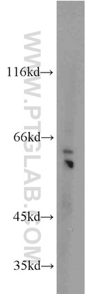 PGCP Antibody in Western Blot (WB)