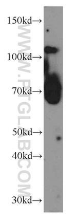 PGCP Antibody in Western Blot (WB)