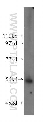 LIPH Antibody in Western Blot (WB)