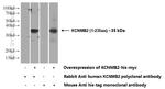 KCNMB2 Antibody in Western Blot (WB)