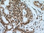 NuMA Antibody in Immunohistochemistry (Paraffin) (IHC (P))