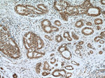 NuMA Antibody in Immunohistochemistry (Paraffin) (IHC (P))