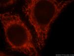 BCL2L13 Antibody in Immunocytochemistry (ICC/IF)